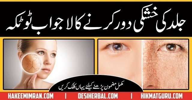 Khushk Jild ( Dry Skin ) Treatmen in Urdu