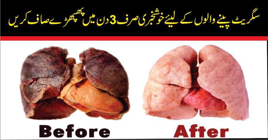 How To Clean Yours Lungs Cigrate Chornay KA Asan Totka